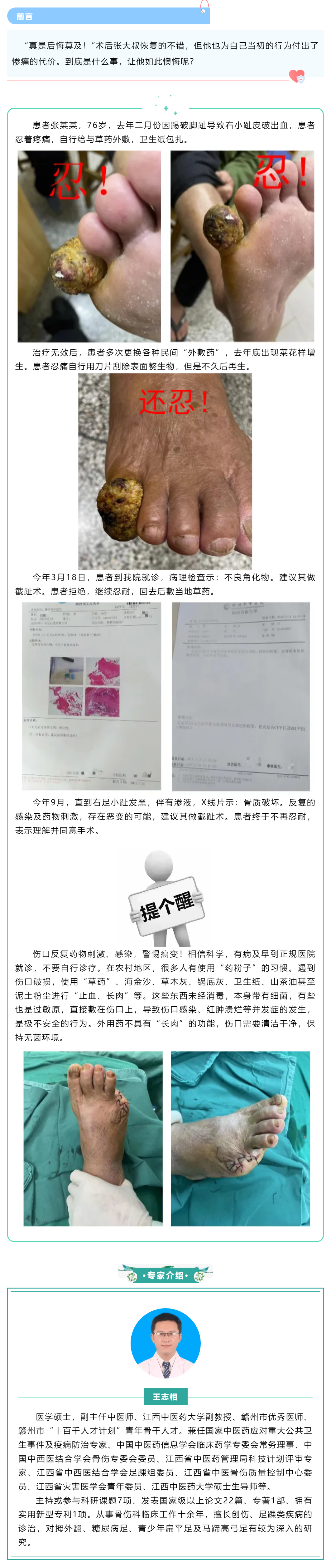 【病案實(shí)錄】小病忍、忍、忍，大病吃苦頭，多么痛的領(lǐng)悟！.png